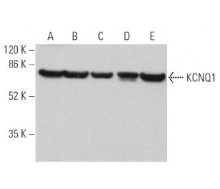 western blotting image from recommended KCNQ1 (G-8) monoclonal antibody replacement. Image 359655