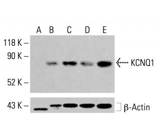 KCNQ1 Antibody (E-7) - Western Blotting - Image 414368