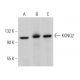 KCNQ2 Antibody (E-6) - Western Blotting - Image 363840