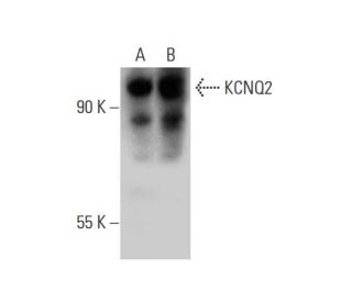 western blotting image from recommended KCNQ2 (C-4) monoclonal antibody replacement. Image 137546