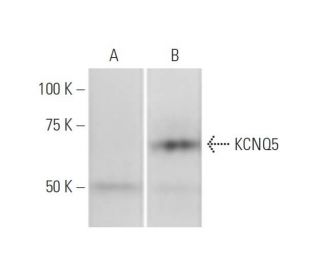 KCNQ5 Antibody (2E2) - Western Blotting - Image 347617 