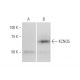 KCNQ5 Antibody (2E2) - Western Blotting - Image 347617 