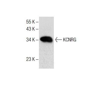 KCNRG Antibody (A-9) - Western Blotting - Image 287657 