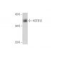 KCTD12 Antibody (F-6) - Western Blotting - Image 137566 