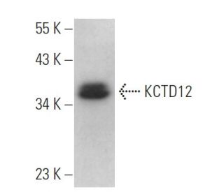 KCTD12 Antibody (F-6) - Western Blotting - Image 371144 