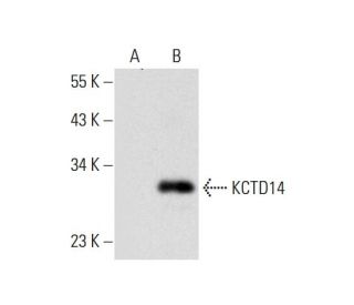 KCTD14 Antibody (H-8) - Western Blotting - Image 299222
