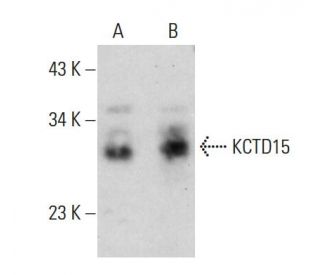 KCTD15 Antibody (AT4C3) - Western Blotting - Image 385148The Double Nickase Plasmid features a U6 promoter for sgRNA expression, a 20 nt targeting sequence, and a gRNA scaffold to guide Cas9n. It includes a CBh promoter for Cas9n (D10A) and puromycin resistance, GFP for transfection verification, and nuclear localization signals (NLS). The 2A peptide allows co-expression of Cas9n and Puro from a single promoter, enabling precise genome editing with reduced off-target effects. 