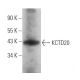 KCTD20 Antibody (B-11) - Western Blotting - Image 369860 