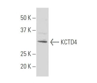 KCTD4 Antibody (NN-07) - Western Blotting - Image 34361