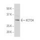 KCTD4 Antibody (NN-07) - Western Blotting - Image 34361