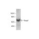 Este anticuerpo policlonal ha dejado de fabricarse. Consulta nuestro anticuerpo monoclonal recomendado <a href="keap1-antibody-g-2">Keap1 (G-2)</a> (se muestran datos de muestra). western blotting image from recommended Keap1 (G-2) monoclonal antibody replacement. Image 143387