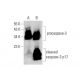 Kendomycin: sc-202196. Western blot analysis of cleaved caspase-3 p17 expression in untreated (A) and Kendomycin treated (