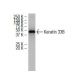 Keratin 33B Antibody (S-28) - Western Blotting - Image 34298 