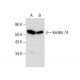 Keratin 74 Antibody (E-6) - Western Blotting - Image 287848 