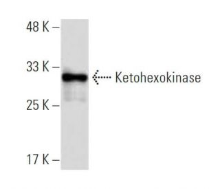 Ketohexokinase Antibody (TT-I) - Western Blotting - Image 33757 