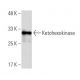 Ketohexokinase Antibody (TT-I) - Western Blotting - Image 33757 