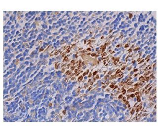 immunohistochemistry image from recommended Ki67 (Ki-67) monoclonal antibody replacement. Image 350548