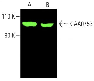 KIAA0753 Antibody (B-3) - Western Blotting - Image 402061 