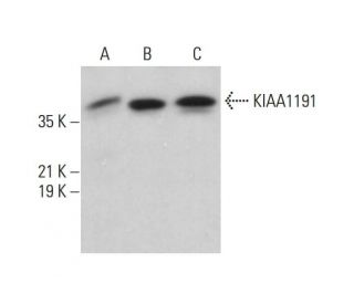 KIAA1191 Antibody (G-4) - Western Blotting - Image 385237 