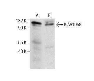 KIAA1958 Antibody (G-12) - Western Blotting - Image 287770 