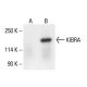 KIBRA Antibody (B-3) - Western Blotting - Image 411258