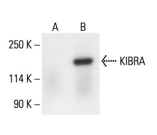 KIBRA Antibody (B-3) - Western Blotting - Image 411258SAM Transcription Activation: SAM system utilizing dCas9-VP64, MS2-P65-HSF1, and sgRNA for precise gene transcription activation.