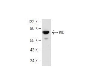 KID Antibody (2486C3a) - Western Blotting - Image 82272 