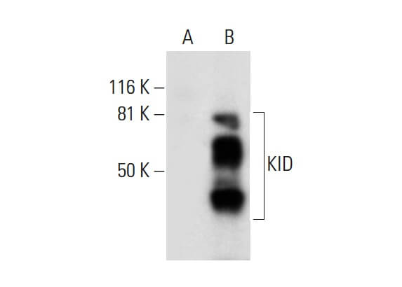 KID Antibody (B-9) | SCBT - Santa Cruz Biotechnology