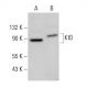 KID Antibody (E-3) - Western Blotting - Image 378770 