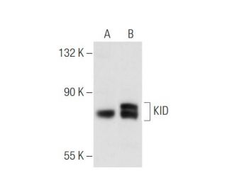 KID Antibody (2486C3a) - Western Blotting - Image 55820