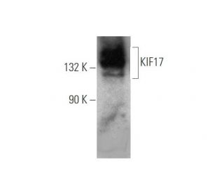 western blotting image from recommended KIF17 (D-8) monoclonal antibody replacement. Image 349272