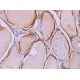 KIF1B Antibody (E-12) - Immunohistochemistry - Image 373634 