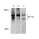 KIF21B Antibody (4C12) - Western Blotting - Image 384446 