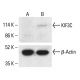 KIF3C Antibody (B-10) - Western Blotting - Image 411756