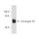 Kininogen HC Antibody (2B5) - Western Blotting - Image 6216 