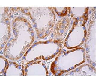 Kininogen LC Antibody (C11C1) - Western Blotting - Image 384641 