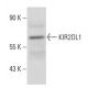 KIR2DL1 Antibody (JJ C11.6) - Western Blotting - Image 16345 