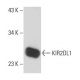 KIR2DL1 Antibody (JJ C11.6) - Western Blotting - Image 16349