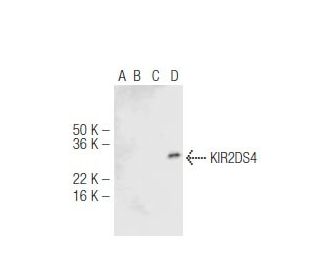 KIR2DS4 Antibody (5F2) - Western Blotting - Image 47922