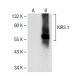 KIR3.1 Antibody (A-4) - Western Blotting - Image 141579