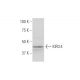 KIR3.4 Antibody (8D2) - Western Blotting - Image 347561 
