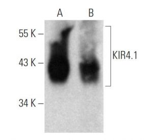 western blotting image from recommended KIR4.1 (1C11) monoclonal antibody replacement. Image 367987