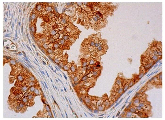 KIR6.2 Antibody (B-9) | SCBT - Santa Cruz Biotechnology