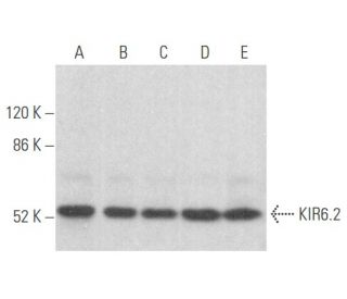 KIR6.2 Antibody (B-9) - Western Blotting - Image 355627 