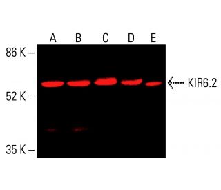 KIR6.2 Antibody (B-9) - Western Blotting - Image 416256 