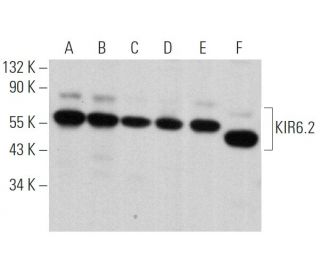 western blotting image from recommended KIR6.2 (B-9) monoclonal antibody replacement. Image 369278