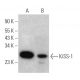 western blotting image from recommended KiSS-1 (24-Q) monoclonal antibody replacement. Image 367988