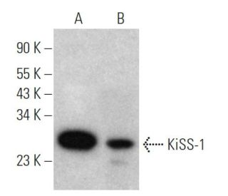 KiSS-1 Antibody (24-Q) - Western Blotting - Image 367988SAM Transcription Activation: SAM system utilizing dCas9-VP64, MS2-P65-HSF1, and sgRNA for precise gene transcription activation.