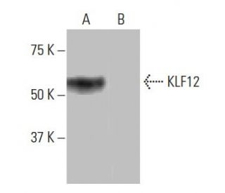 KLF12 Antibody (NQ-C45) - Western Blotting - Image 64984