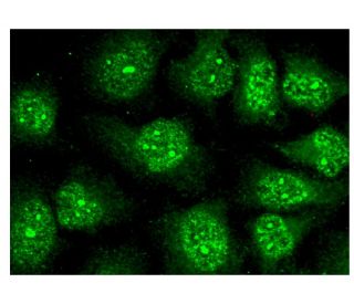 KLF17 Antibody (B-6) - Immunofluorescence - Image 302180 